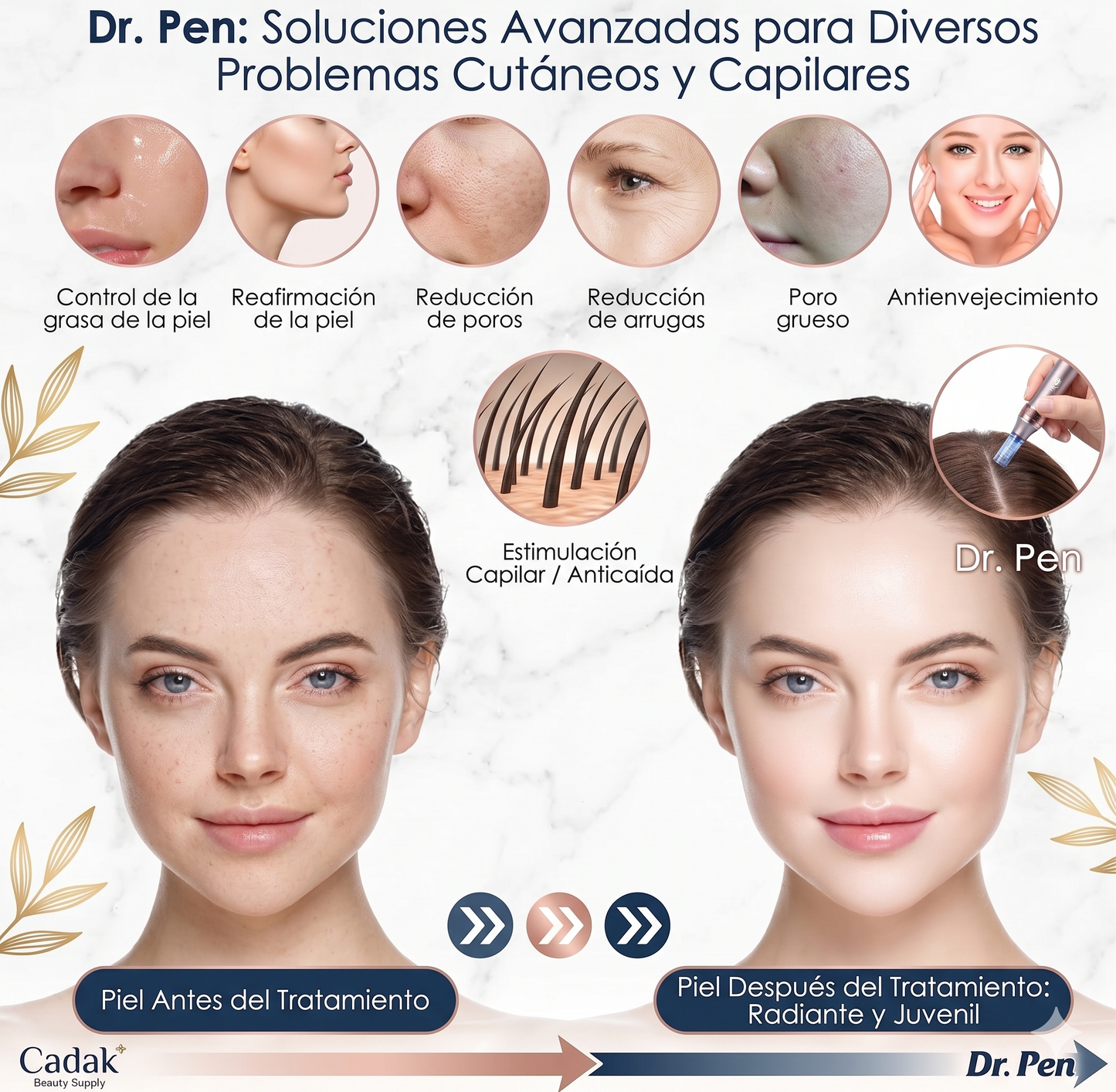 Dispositivo Dr. Pen Ultima M8 – Microneedling Profesional